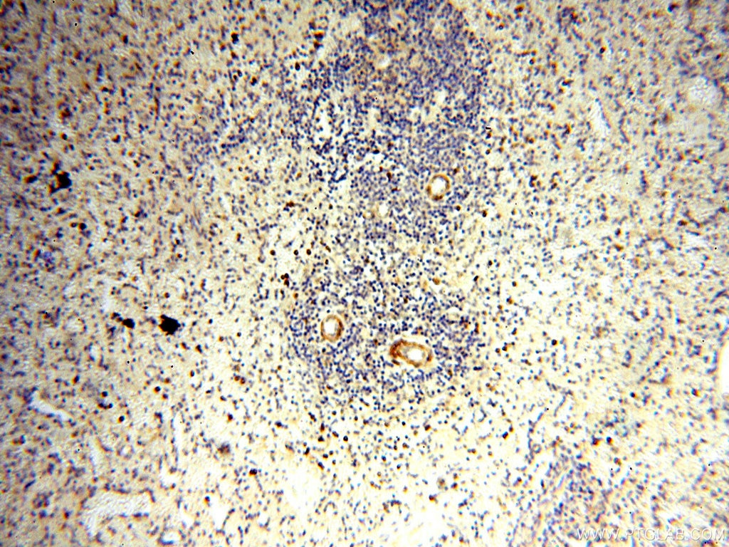 Immunohistochemistry (IHC) staining of human spleen tissue using BOLA1 Polyclonal antibody (18017-1-AP)