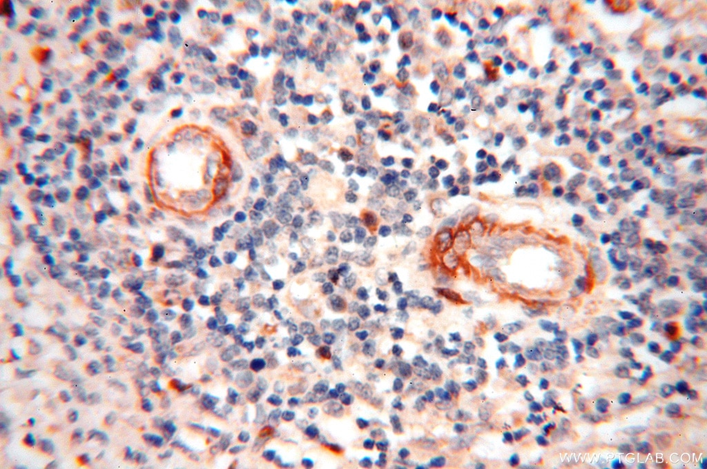 Immunohistochemistry (IHC) staining of human spleen tissue using BOLA1 Polyclonal antibody (18017-1-AP)