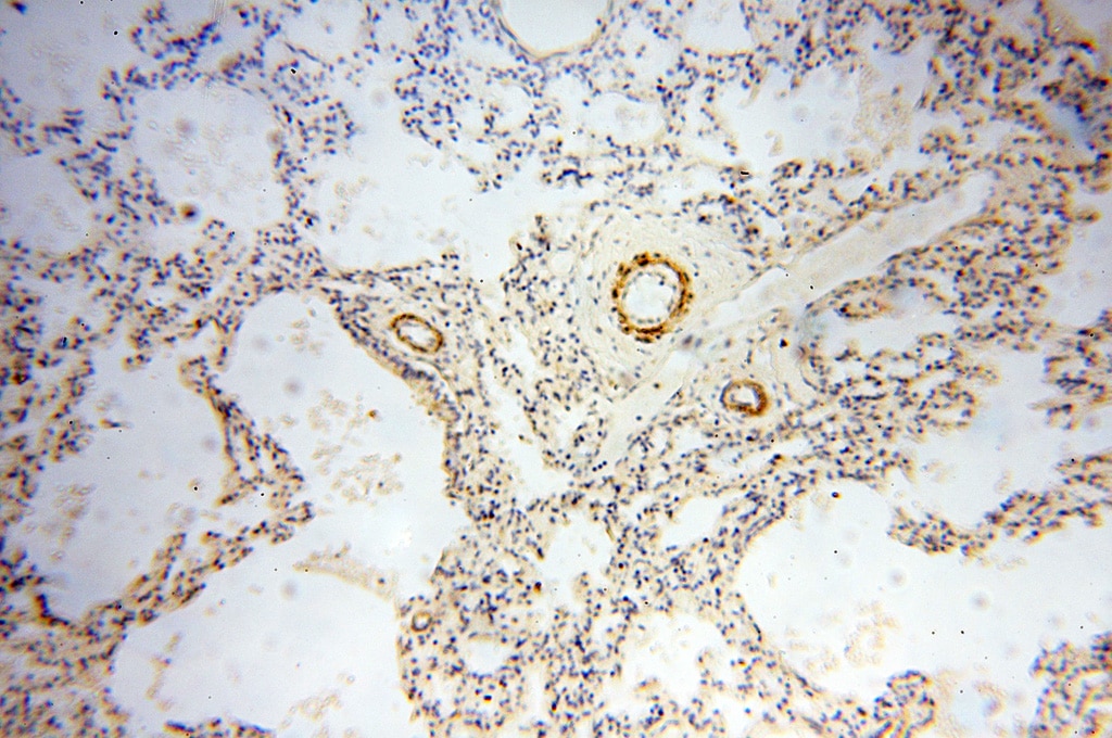 Immunohistochemistry (IHC) staining of human lung tissue using BOLA1 Polyclonal antibody (18017-1-AP)