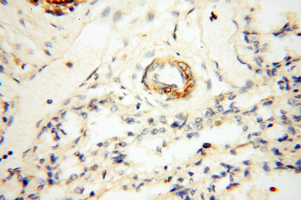 Immunohistochemistry (IHC) staining of human lung tissue using BOLA1 Polyclonal antibody (18017-1-AP)