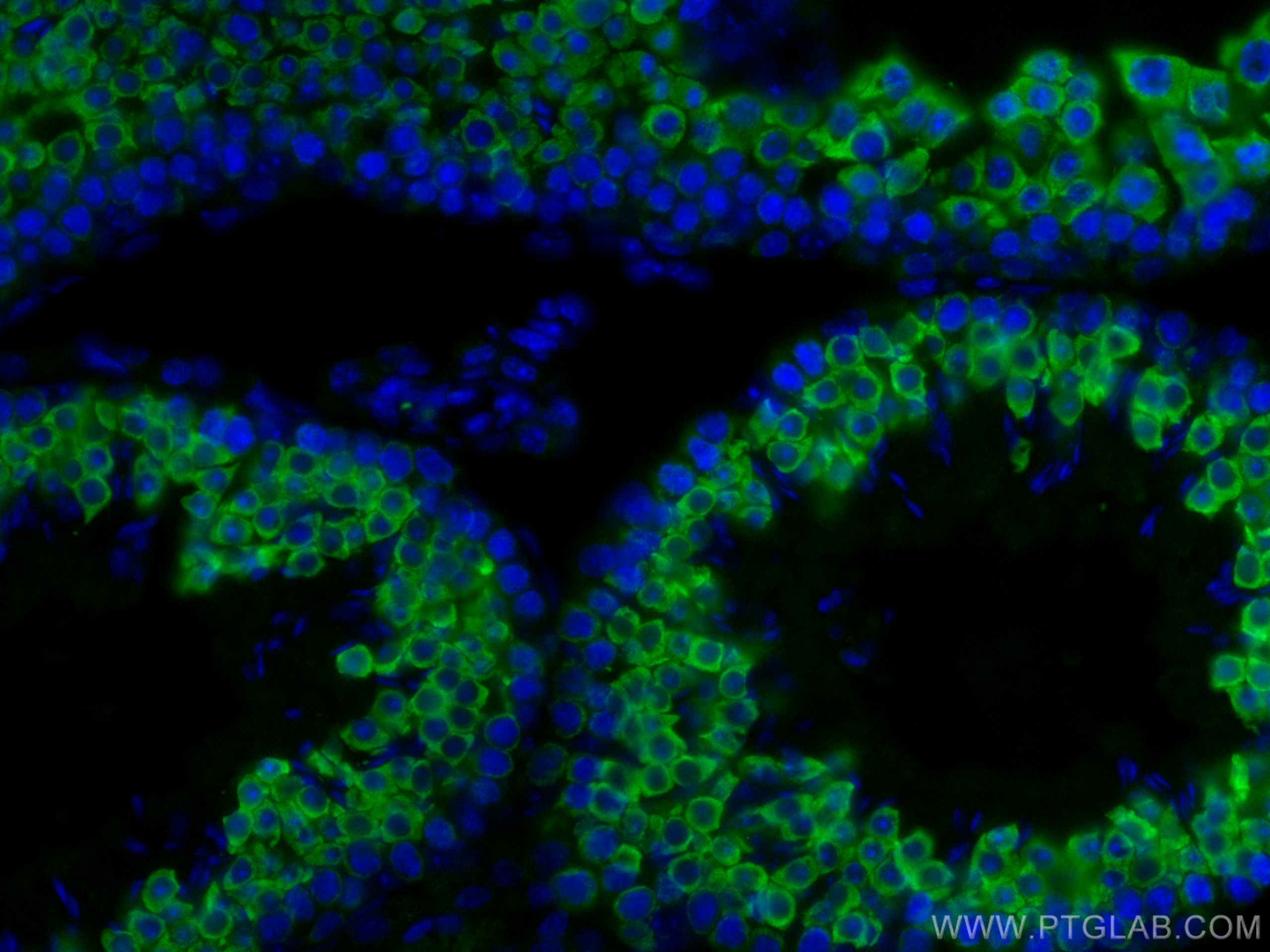 IF Staining of mouse testis using 13720-1-AP