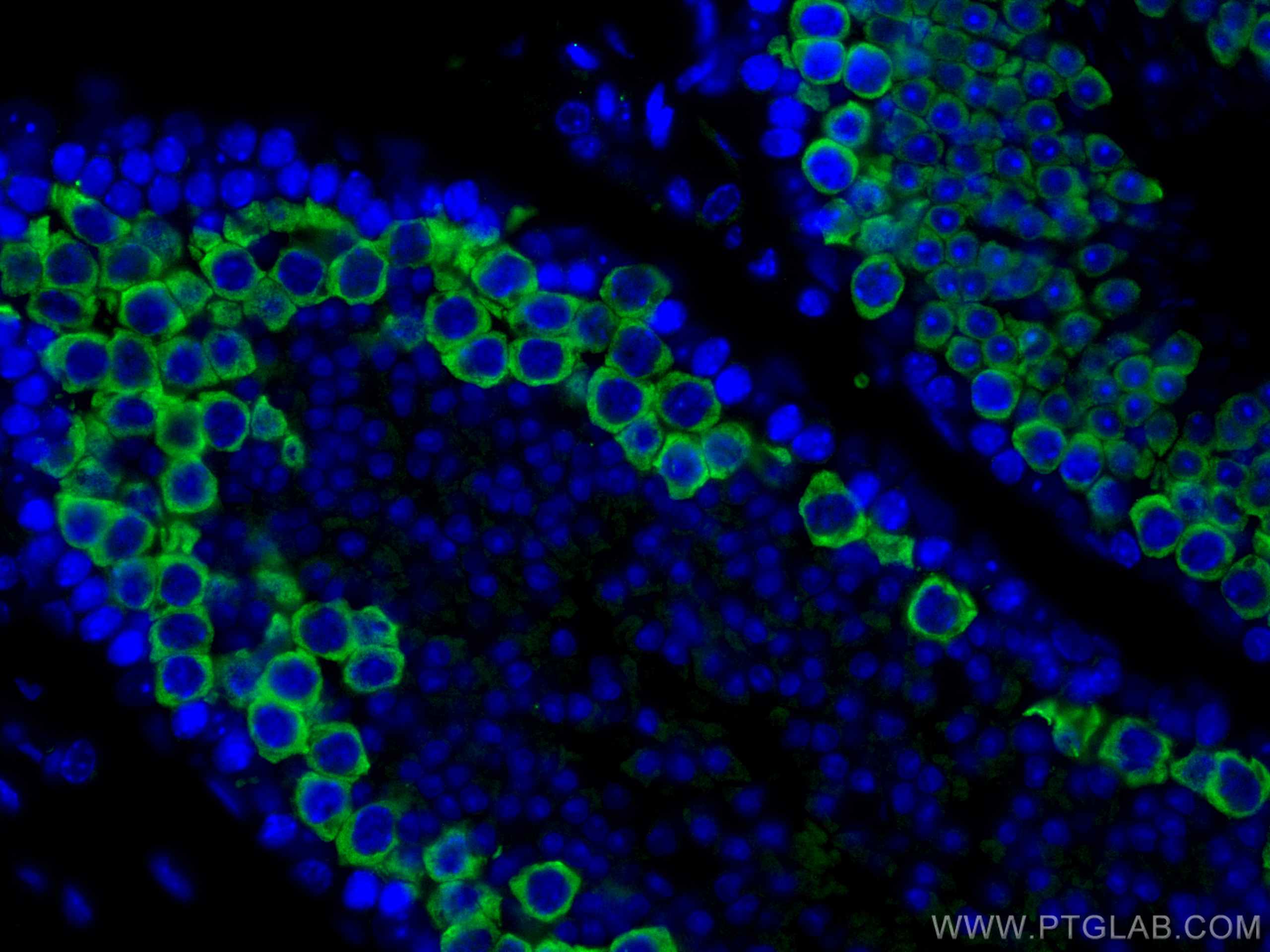 IF Staining of mouse testis using 13720-1-AP