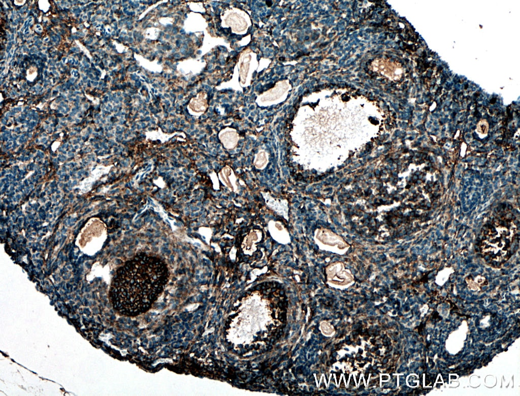 Immunohistochemistry (IHC) staining of mouse ovary tissue using BOULE Polyclonal antibody (13720-1-AP)