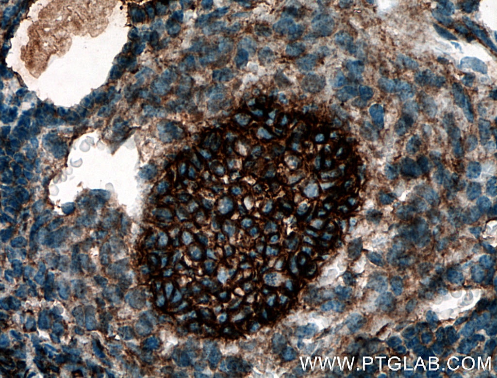 Immunohistochemistry (IHC) staining of mouse ovary tissue using BOULE Polyclonal antibody (13720-1-AP)