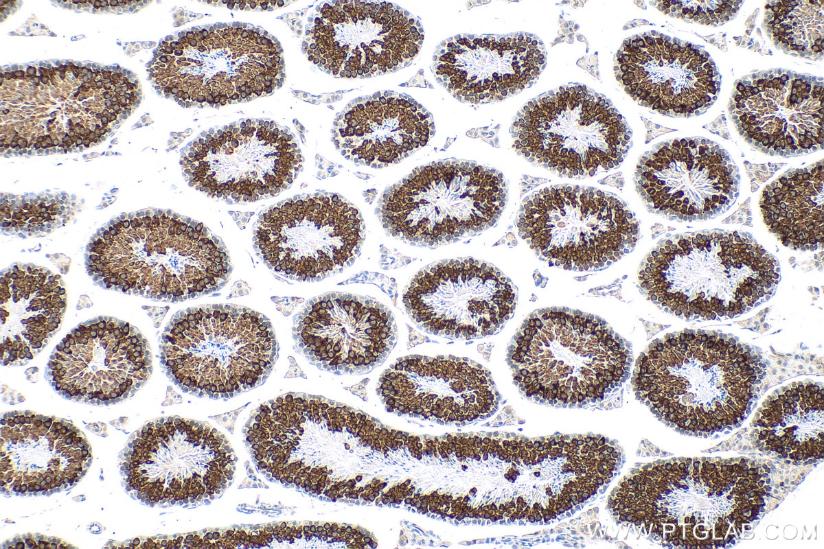 IHC staining of mouse testis using 13720-1-AP