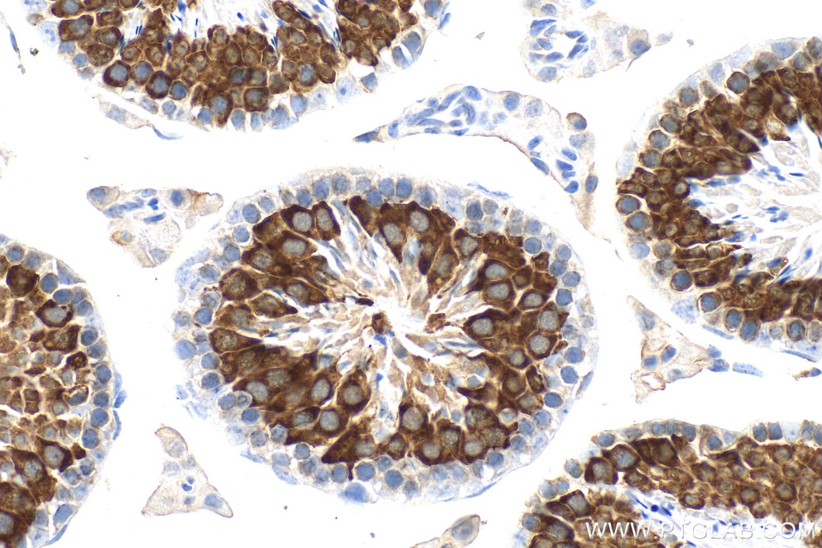 Immunohistochemistry (IHC) staining of mouse testis tissue using BOULE Polyclonal antibody (13720-1-AP)