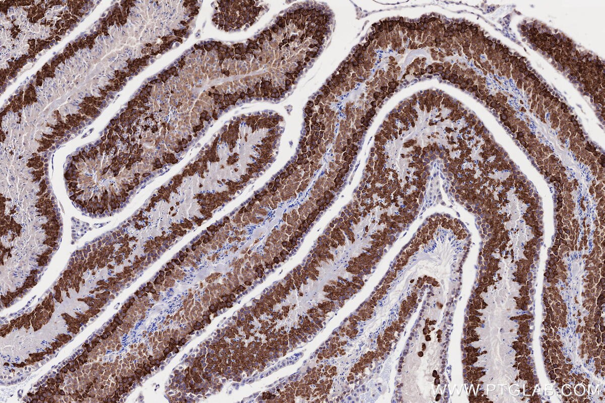 IHC staining of mouse testis using 13720-1-AP Immunohistochemistry (IHC) staining of mouse testis tissue using BOULE Polyclonal antibody (13720-1-AP)