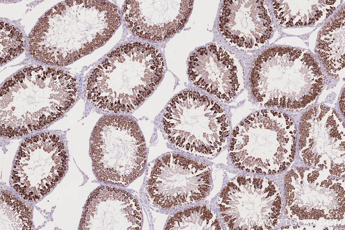 IHC staining of rat testis using 13720-1-AP Immunohistochemistry (IHC) staining of rat testis tissue using BOULE Polyclonal antibody (13720-1-AP)