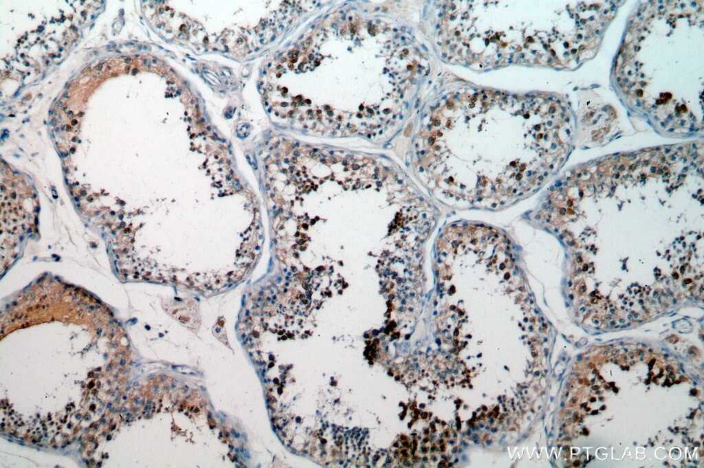 Immunohistochemistry (IHC) staining of human testis tissue using BOULE Polyclonal antibody (13720-1-AP)