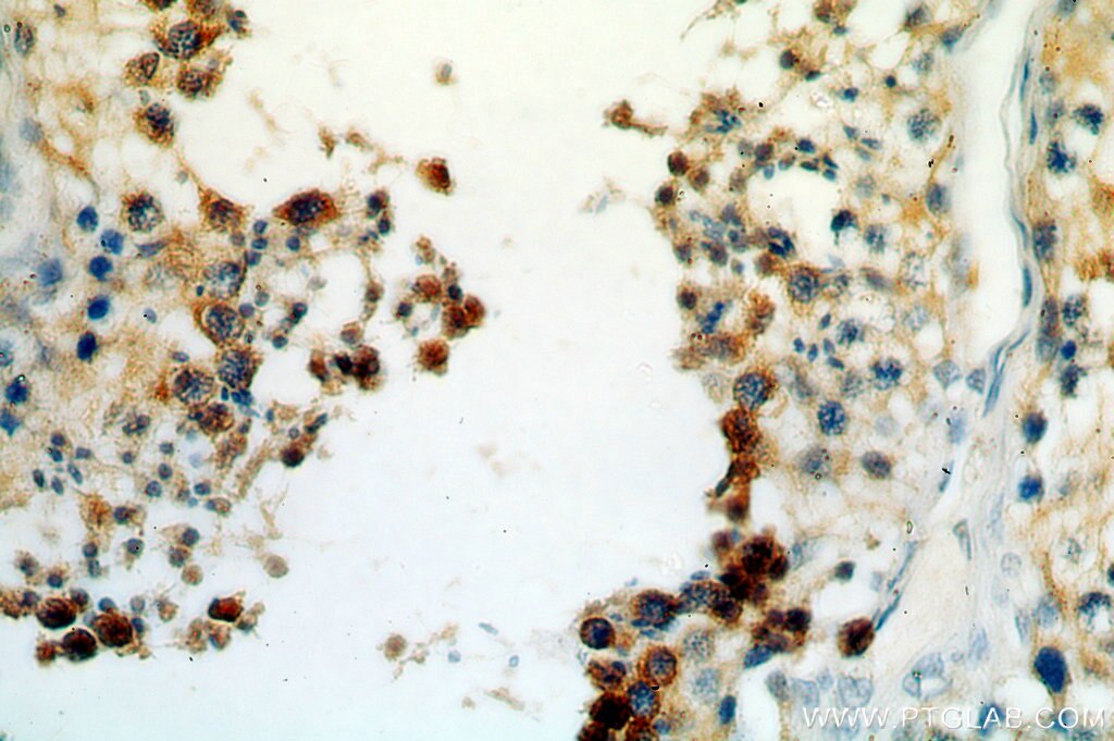 IHC staining of human testis using 13720-1-AP