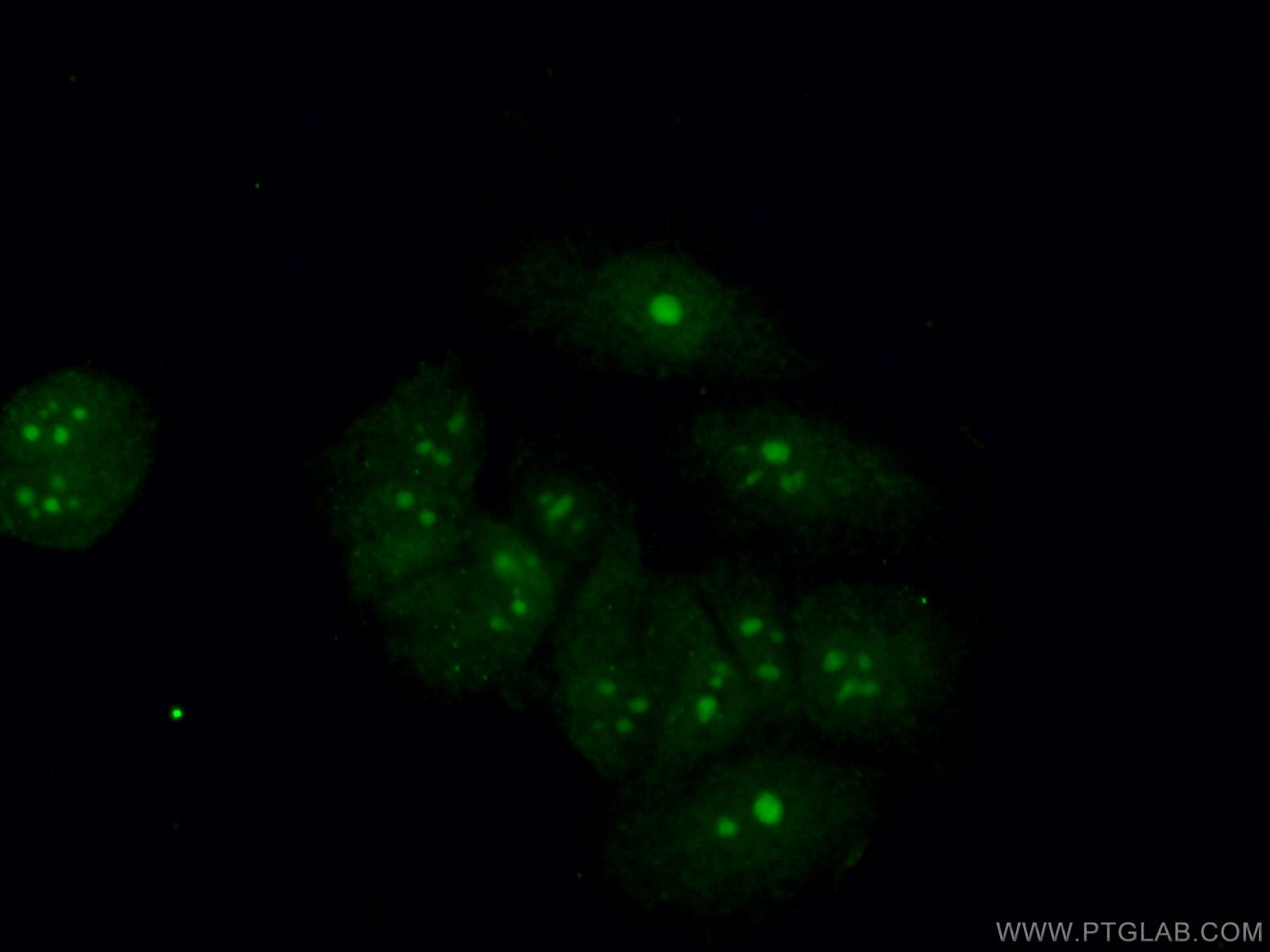 Immunofluorescence (IF) / fluorescent staining of MCF-7 cells using BOP1 Polyclonal antibody (28366-1-AP)