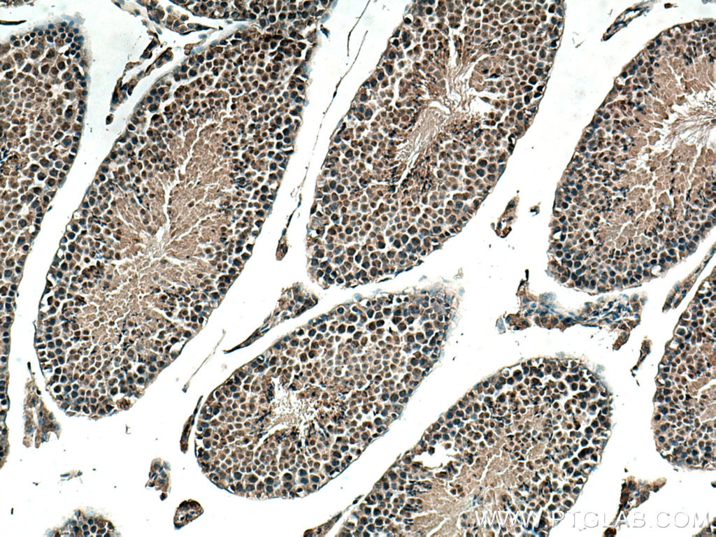 Immunohistochemistry (IHC) staining of mouse testis tissue using BOP1 Polyclonal antibody (28366-1-AP)