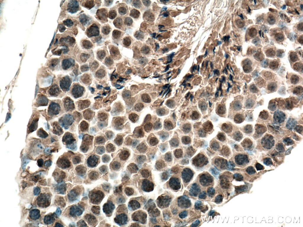 Immunohistochemistry (IHC) staining of mouse testis tissue using BOP1 Polyclonal antibody (28366-1-AP)
