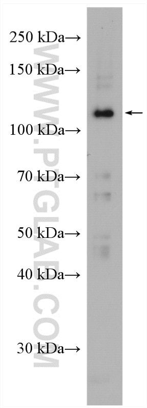 Western Blot (WB) analysis of NCI-H1299 cells using BOP1 Polyclonal antibody (28366-1-AP)