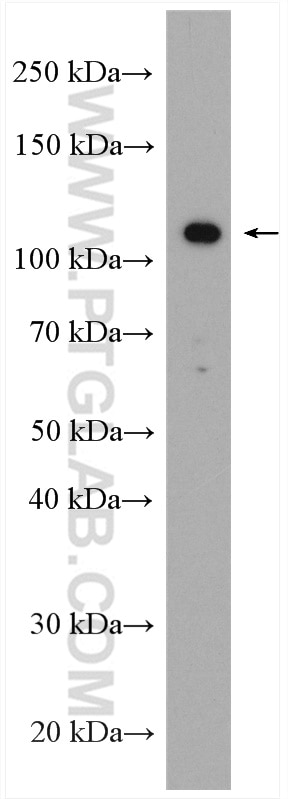 Western Blot (WB) analysis of DU 145 cells using BOP1 Polyclonal antibody (28366-1-AP)