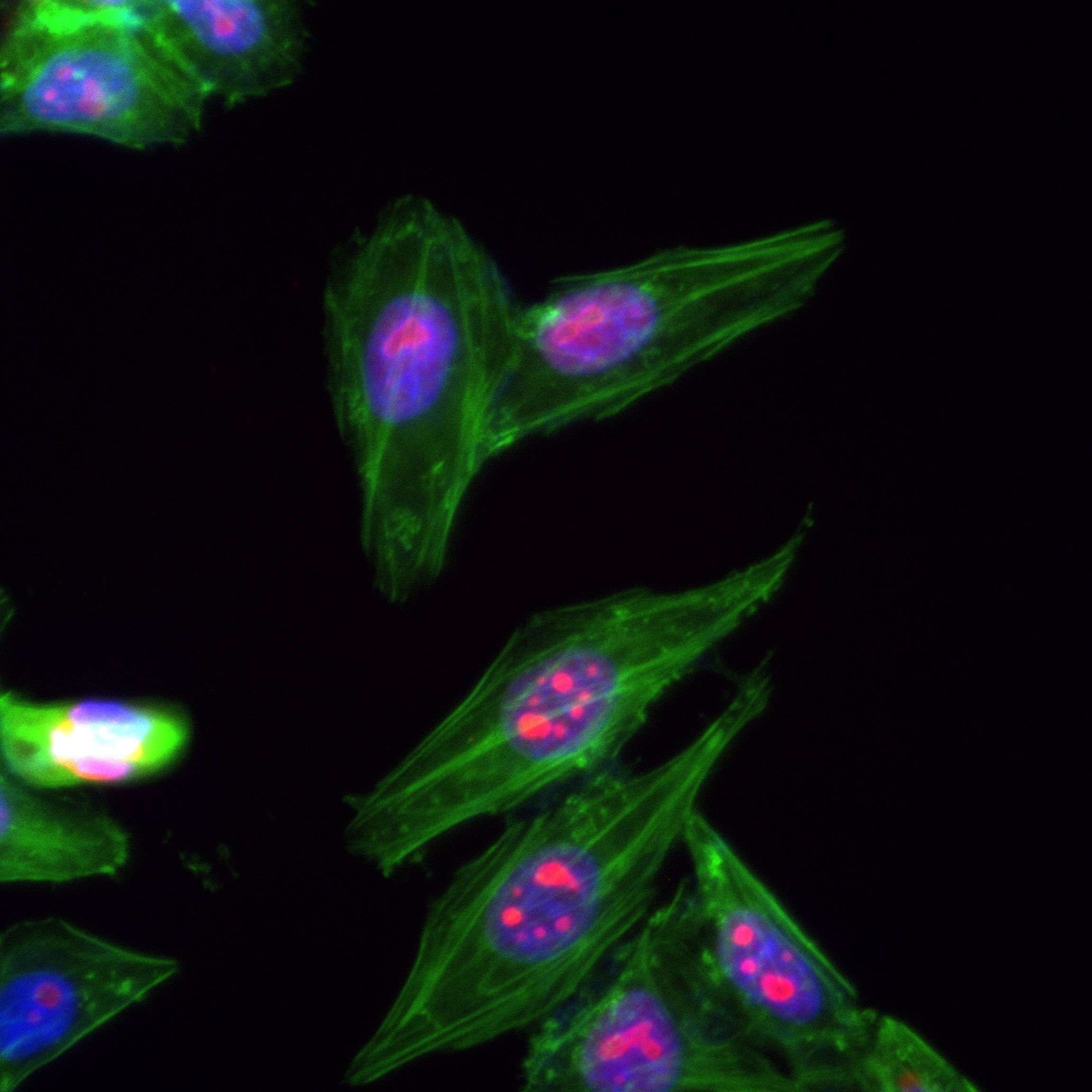 Immunofluorescence (IF) / fluorescent staining of HepG2 cells using BOP1 Recombinant antibody (82742-3-RR)