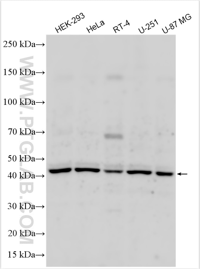 WB analysis using 33196-1-AP (same clone as 33196-1-PBS) Western Blot (WB) analysis of various lysates using BORC6 Polyclonal antibody (33196-1-AP)