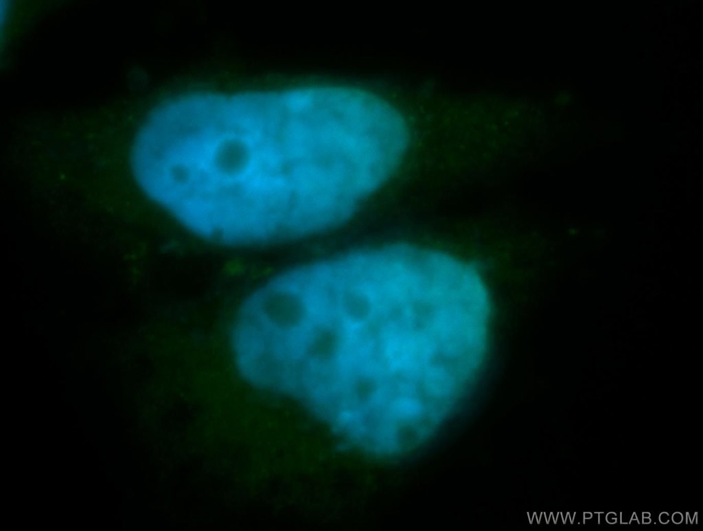Immunofluorescence (IF) / fluorescent staining of SH-SY5Y cells using BORIS Polyclonal antibody (11074-2-AP)