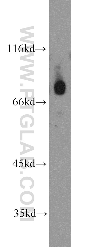 Western Blot (WB) analysis of PC-3 cells using BORIS Polyclonal antibody (11074-2-AP)