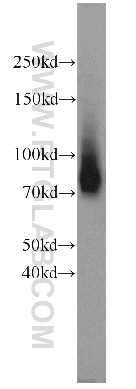 Western Blot (WB) analysis of rat testis tissue using BORIS Polyclonal antibody (11074-2-AP)