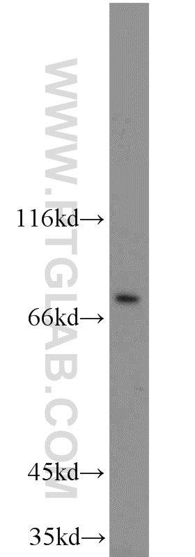 Western Blot (WB) analysis of mouse testis tissue using BORIS Polyclonal antibody (11074-2-AP)