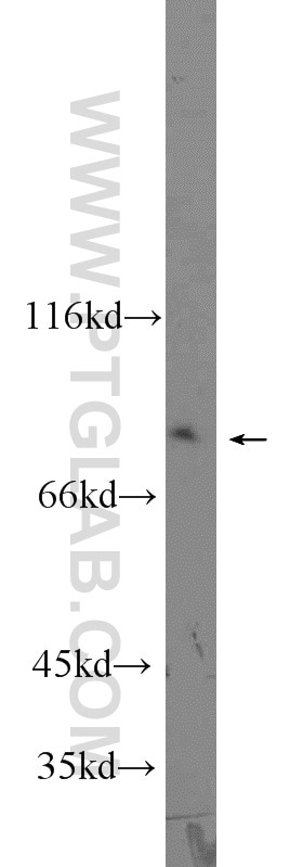 Western Blot (WB) analysis of HeLa cells using BORIS Polyclonal antibody (11074-2-AP)