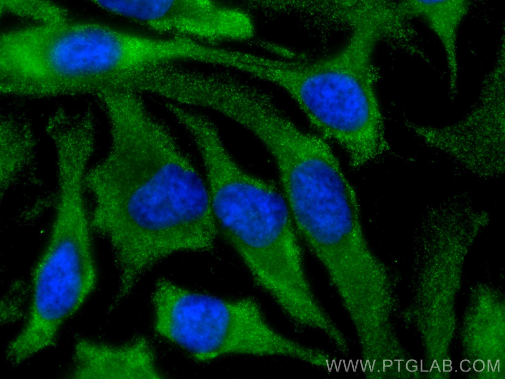Immunofluorescence (IF) / fluorescent staining of HeLa cells using BORIS Monoclonal antibody (60079-1-Ig)