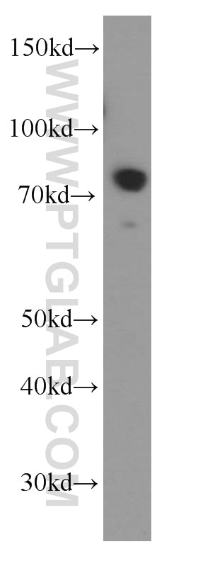 Western Blot (WB) analysis of HeLa cells using BORIS Monoclonal antibody (60079-1-Ig)