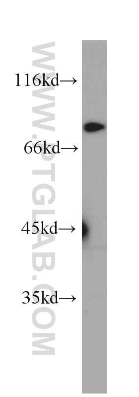 Western Blot (WB) analysis of HeLa cells using BORIS Monoclonal antibody (60079-1-Ig)