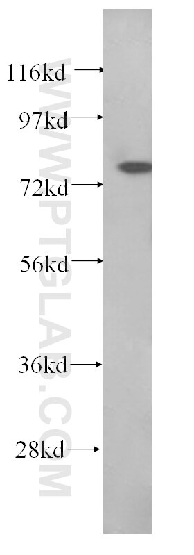 Western Blot (WB) analysis of SMMC-7721 cells using BORIS Monoclonal antibody (60079-1-Ig)