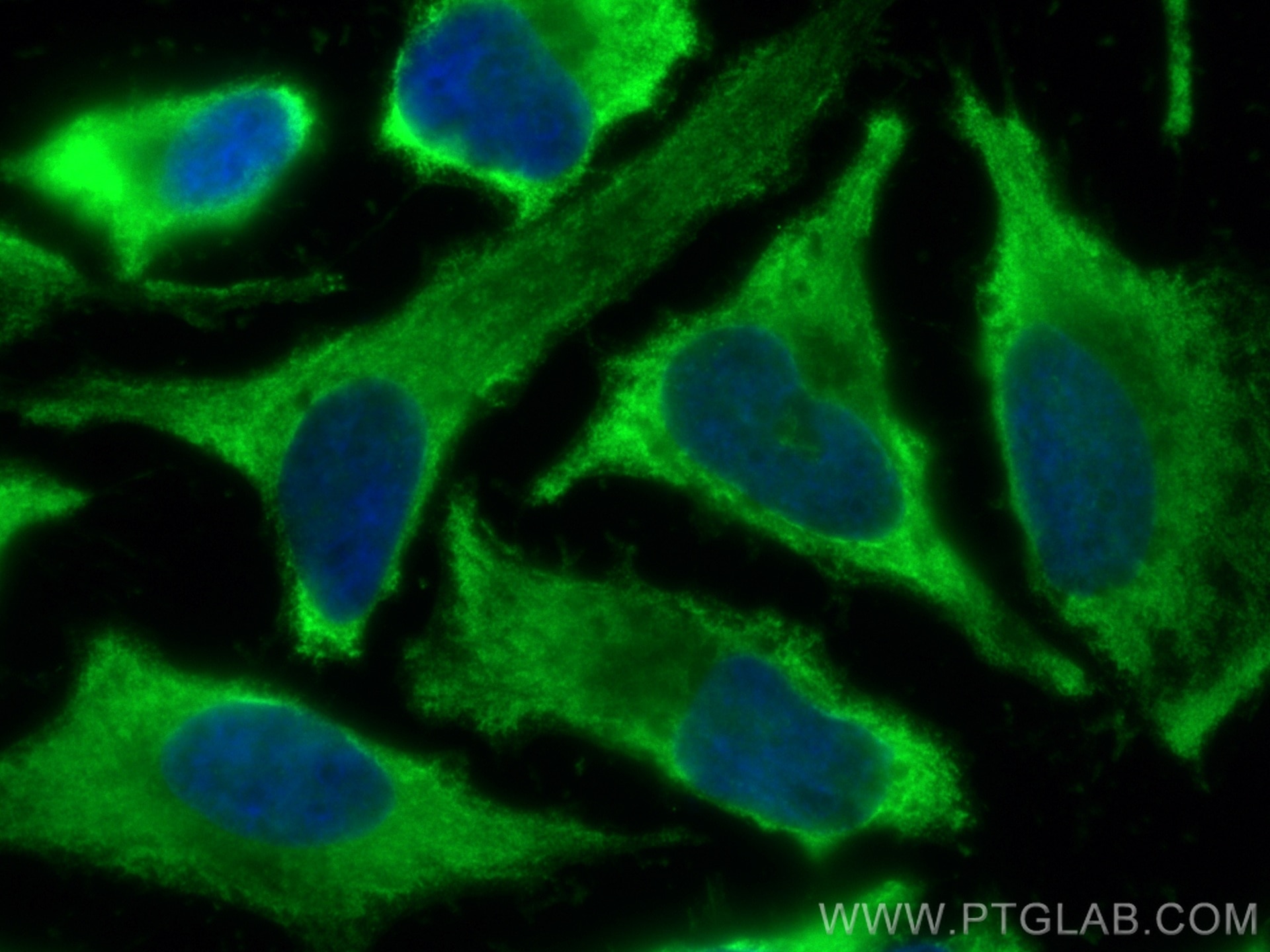 Immunofluorescence (IF) / fluorescent staining of HeLa cells using CoraLite® Plus 488-conjugated BORIS Monoclonal ant (CL488-60079)