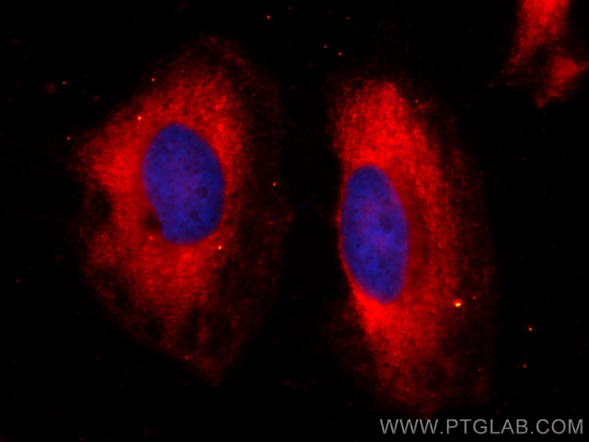 Immunofluorescence (IF) / fluorescent staining of HeLa cells using CoraLite®594-conjugated BORIS Monoclonal antibody (CL594-60079)