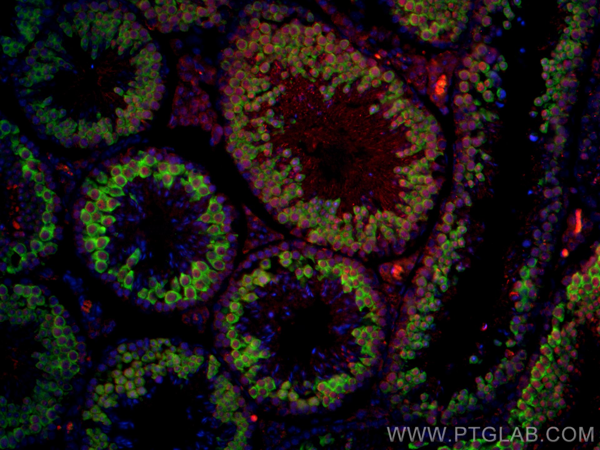 Human CCL18/PARC Fluorescein-conjugated Antibody IC394F: R&D Systems