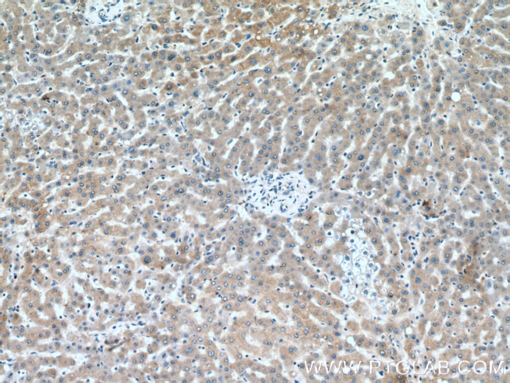 Immunohistochemistry (IHC) staining of human liver tissue using BPGM Polyclonal antibody (17173-1-AP)
