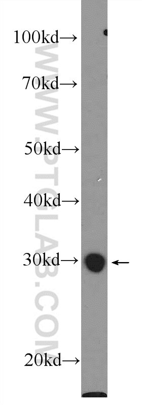 Western Blot (WB) analysis of mouse liver tissue using BPGM Polyclonal antibody (17173-1-AP)