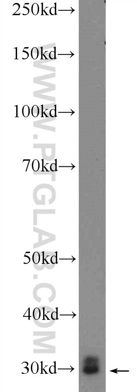 Western Blot (WB) analysis of rat liver tissue using BPGM Polyclonal antibody (17173-1-AP)