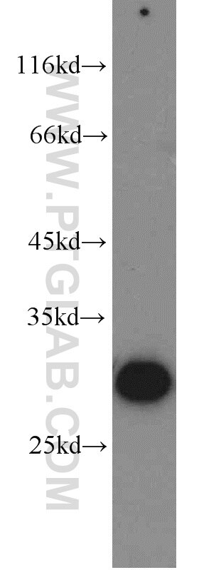 Western Blot (WB) analysis of human plasma using BPGM Polyclonal antibody (17173-1-AP)