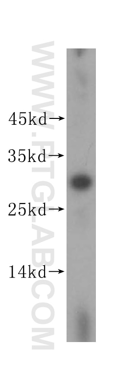 Western Blot (WB) analysis of human plasma using BPGM Polyclonal antibody (17173-1-AP)