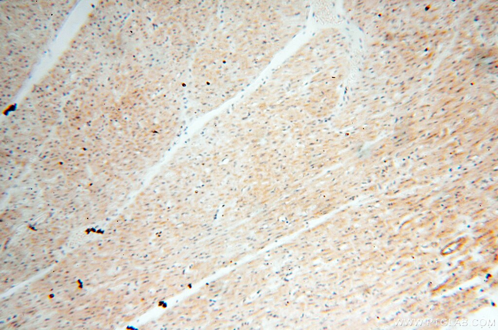 Immunohistochemistry (IHC) staining of human heart tissue using BPHL Polyclonal antibody (17974-1-AP)