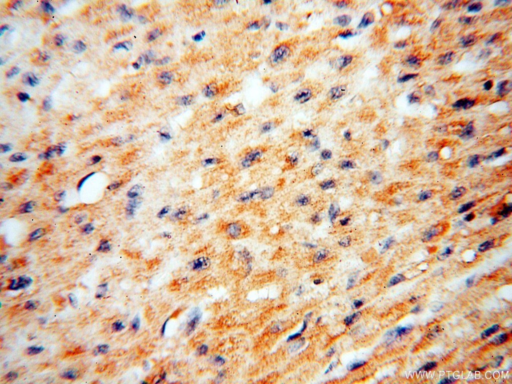 IHC staining of human heart using 17974-1-AP