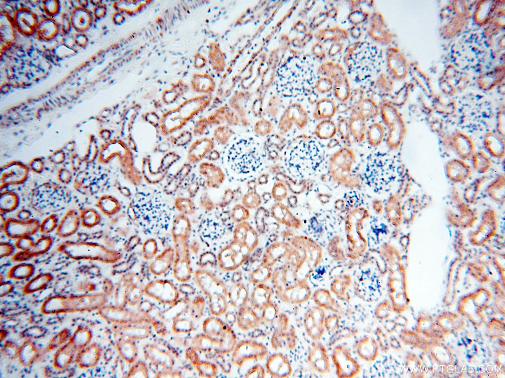 Immunohistochemistry (IHC) staining of human kidney tissue using BPHL Polyclonal antibody (17974-1-AP)