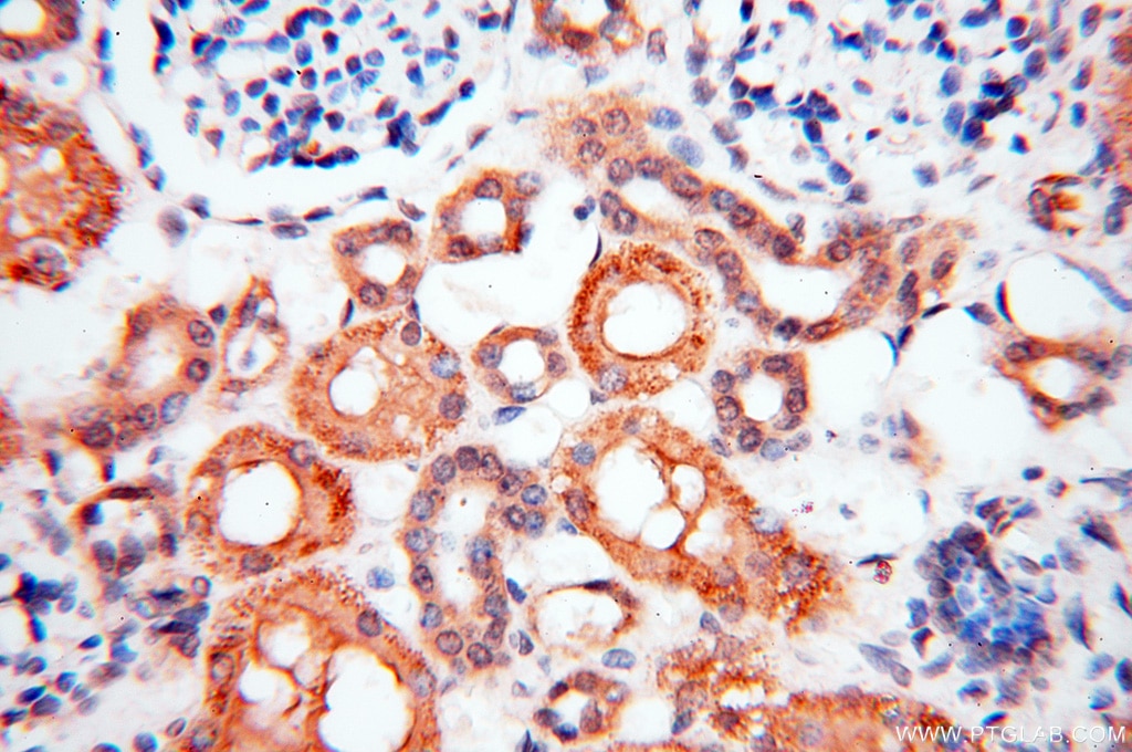 Immunohistochemistry (IHC) staining of human kidney tissue using BPHL Polyclonal antibody (17974-1-AP)