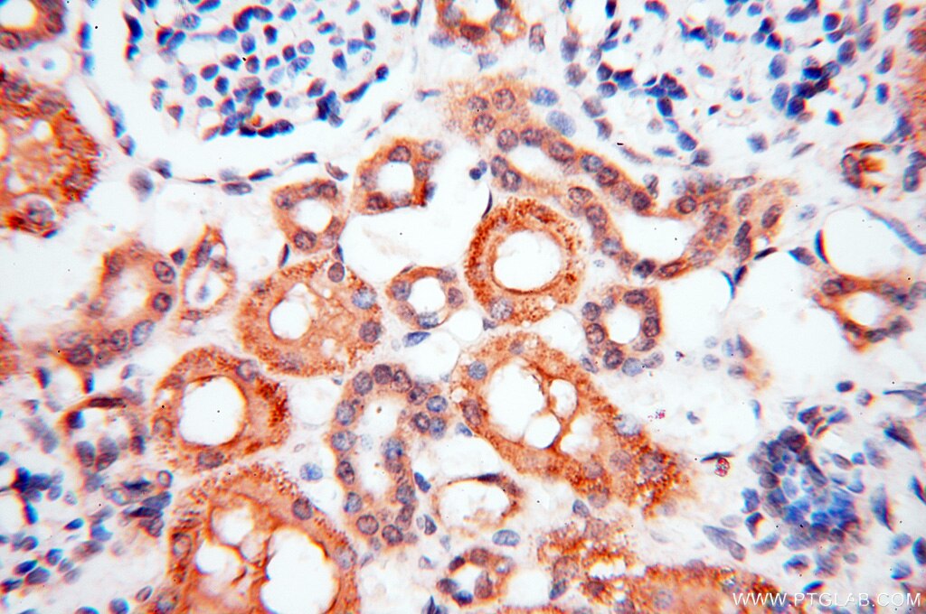 IHC staining of human kidney using 17974-1-AP