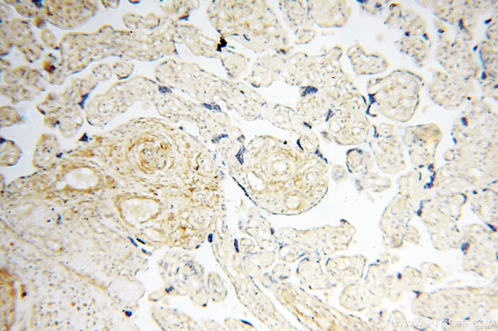 Immunohistochemistry (IHC) staining of human placenta tissue using BPHL Polyclonal antibody (17974-1-AP)