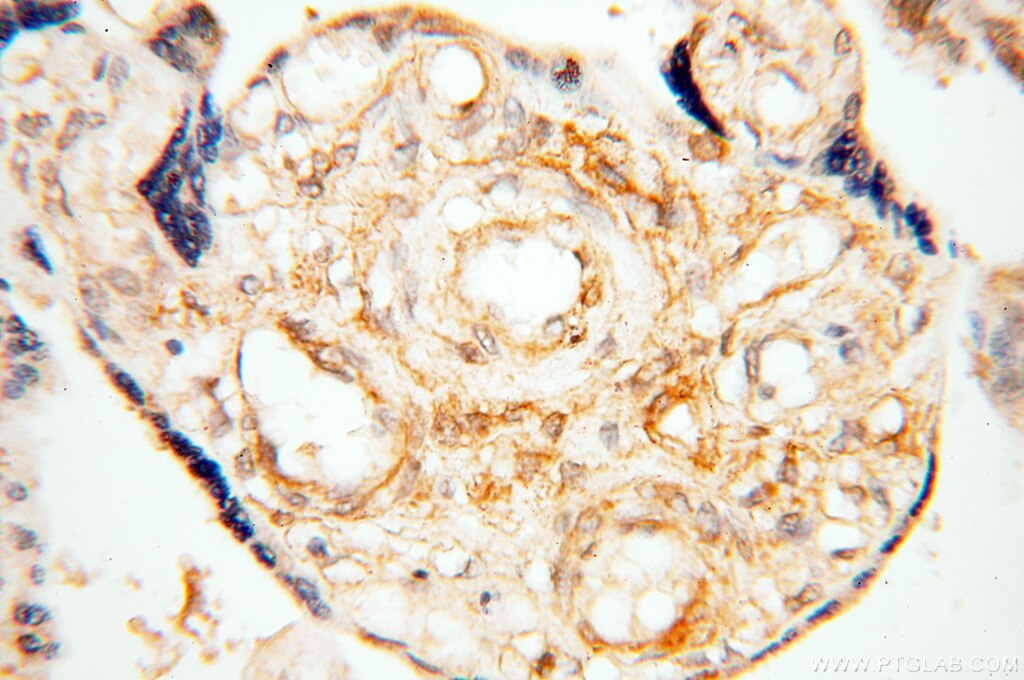 IHC staining of human placenta using 17974-1-AP