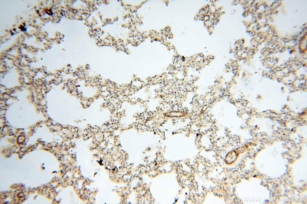 Immunohistochemistry (IHC) staining of human lung tissue using BPHL Polyclonal antibody (17974-1-AP)