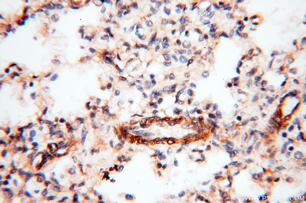 Immunohistochemistry (IHC) staining of human lung tissue using BPHL Polyclonal antibody (17974-1-AP)