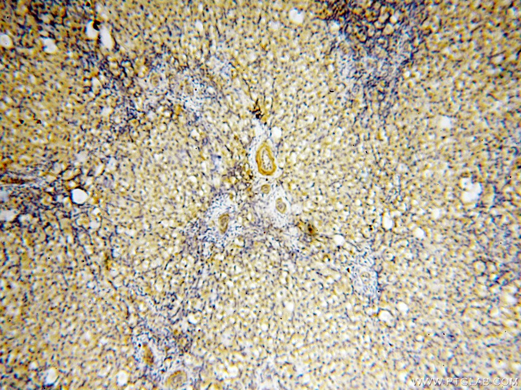 Immunohistochemistry (IHC) staining of human ovary tissue using BPHL Polyclonal antibody (17974-1-AP)