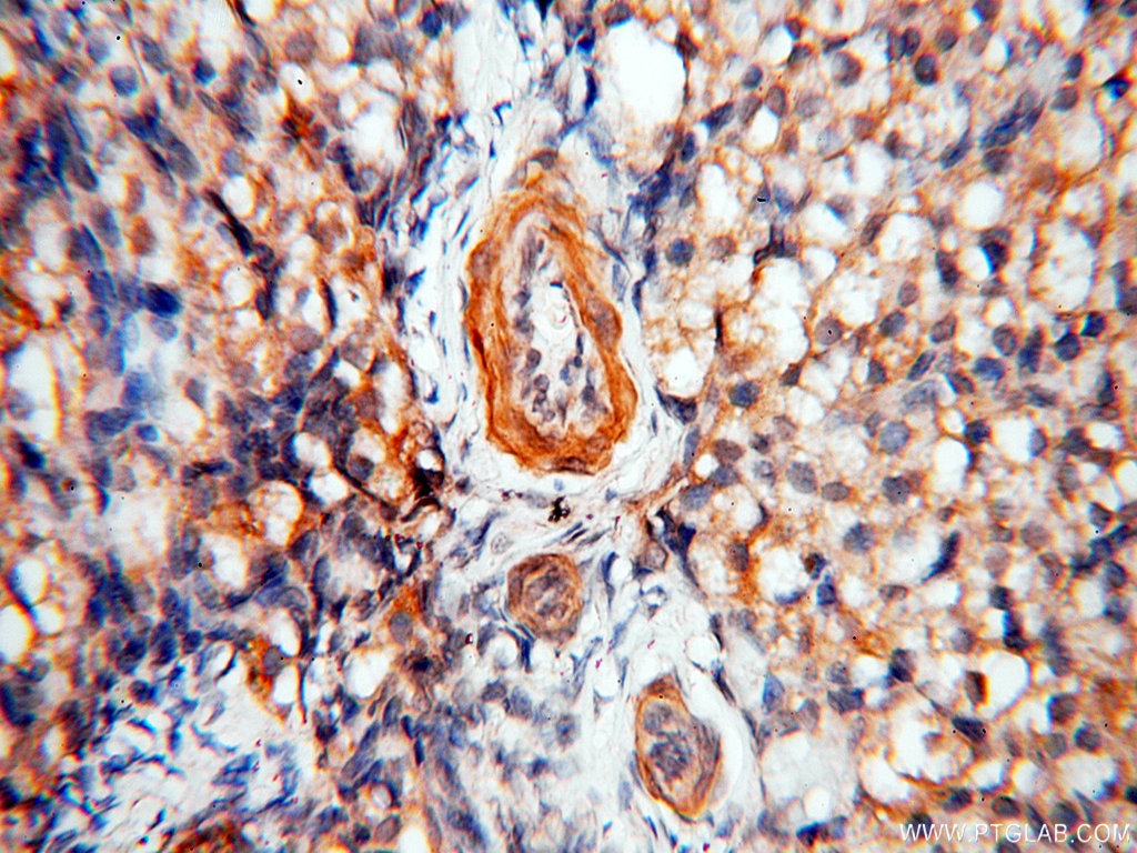 Immunohistochemistry (IHC) staining of human ovary tissue using BPHL Polyclonal antibody (17974-1-AP)