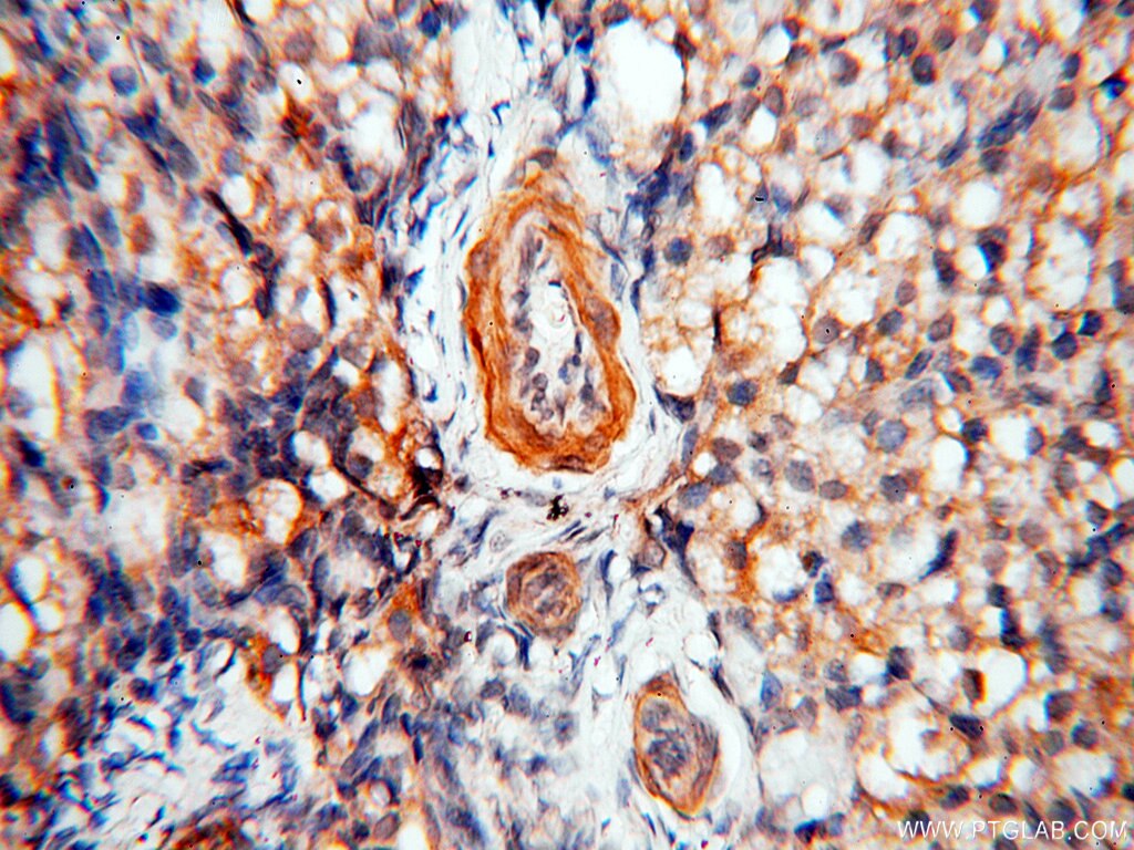 IHC staining of human ovary using 17974-1-AP